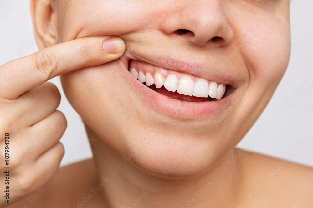 Soins des gencives parodontie